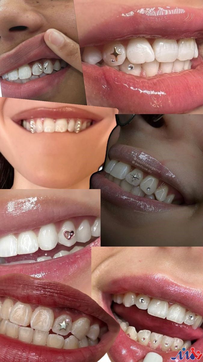 زیبایی بی‌خطر با خدمات تخصصی پیرسینگ و نگین دندان